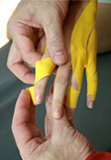 Medi-Taping-Therapie an der Hand