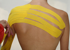 Medi-Taping am Rücken